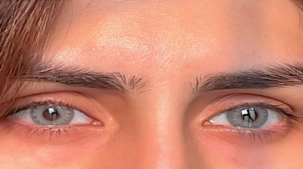 SKY - Free Lens Kit